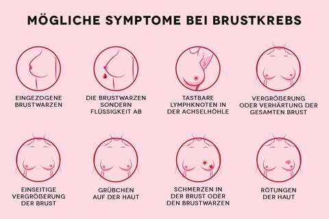 4. Knoten oder Verhärtungen